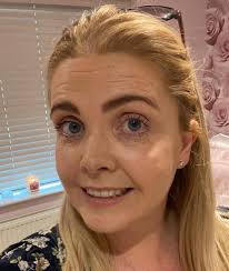 I booked in with BM Skincare for a dermaplaning session ☺️ and what lovely  results 🥰 its a non invasive treatment