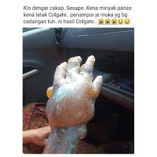 Cara memutihkan gigi kuning yang membandel secara alami. Cara Nak Bagi Demam Guna Ubat Gigi