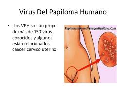 Check spelling or type a new query. Virus Del Papiloma Humano