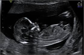 Each pregnancy ultrasound scan is pretty exciting (you get to see your baby) and slightly scary you get what ultrasounds do, but how do they work? Pregnancy Week 13