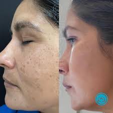 Zoë Bernard (Arscott), HOLISTIC SKIN EXPERT