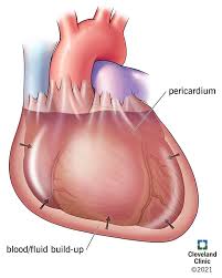 Image result for Pericardium