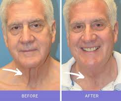 Typically, the safest hairstyles for women over fifty are short bobs and medium length haircuts. Plastic Surgery Of Texas Dr Tittle