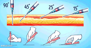 Igne Yapmanin Puf Noktalari