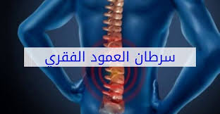 سرطان العمود الفقري أعراضه وطرق العلاج
