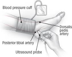 Because blood pressure varies throughout the day, your doctor will rarely diagnose hypertension on the basis of a single reading. Ankle Brachial Index Harvard Health