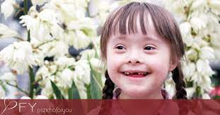 Trisizomia néven egy olyan állapot, mellyel született. Down Szindroma Na Es 3 Video Amit Erdemes Megnezni A Down Szindroma Vilagnapjan