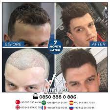 7 Month Later