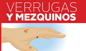 Verrugas O Mezquinos Motivos Para Ir Al Doctor Grupo Milenio