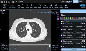 Be on caution for there are five essential approaches to treat nsclc Moscow Doh Uses Ai Platform To Detect Lung Cancer Symptoms Healthcare It News