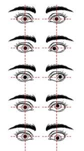 Image result for Strabismus