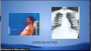 Contextual translation of apico lordotic into tagalog. Ce4rt Radiographic Positioning Of The Chest For X Ray Techs