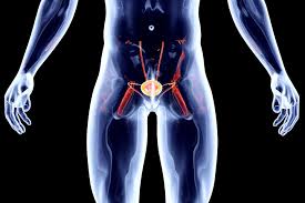 Рак простаты у мужчин - симптомы, причины и стадии рака предстательной  железы