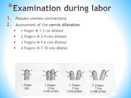 Every finger that can be healthy inside has to do with one cm dilation. Modified By Dr Amaal Rayan Ppt Video Online Download