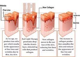 Red Light Therapy Beds At Planet Fitness - Buy Whole Body Red Light Therapylight Therapy Collagen Bed For Salered Led Skin Treatment Product On Alibabacom
