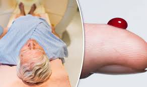How does prostate cancer develop? Blood Test Can Predict Aggressive Form Of Prostate Cancer Express Co Uk