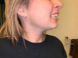 BRIGHAM ORTHODONTICS