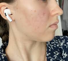 We are passionate about skincare and the products we sell are ones we use ourselves. The Ordinary Niacinamide 10 Zinc 1