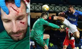 Kemar roofe was sent off for a high tackle on slavia prague's goalkeeper. Slavia Prague Keeper Ondrej Kolar Left With Horrific Eye Cuts After Kemar Roofe S Kung Fu Tackle Daily Mail Online