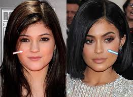 Reality television series keeping up with the kardashians since 2007 and is the founder and owner of cosmetic company kylie cosmetics. Kylie Jenner Nose Job Before And After Surgery Plasticsurgery Kylie Jenner Plastic Surgery Kylie Jenner Nose Job Kylie Jenner Nose
