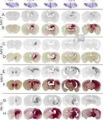 Image result for White 1997 AAV