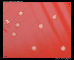 Move the stage (the flat ledge the slide sits on) down to its lowest place the glass slide onto the stage. Listeria Monocytogenes Cell Morphology Gram Stain And Cell Arrangement Micrograph Of L Monocytogenes Morphology Of Listeria Under The Microscope
