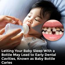 Some studies highlight that letting a baby sleep with a milk or juice  bottle can cause Baby Bottle Caries, early dental cavities that spread  faster in children's thinner enamel. While some parents
