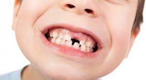 Sonhos Significado Sonhar Com Dente Saiba que sonhar que está arrancando um dente é algo bastante comum de acontecer. sonhos significado sonhar com dente