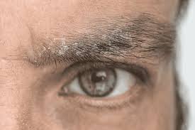 Smaller amounts of circulating thyroid hormone mean fewer thyroid hormone interactions on your hair follicles which means potentially more hair loss. How To Identify And Prevent Eyebrow Hair Loss Hair Sure
