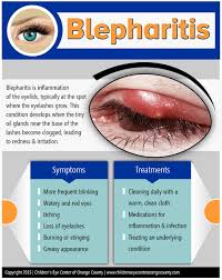 Blepharitis Dr Golareh Fazilat Md Eye Facts Eye Care Health Blepharitis