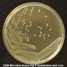 Salmonella infection (salmonellosis) is a common bacterial disease that affects the intestinal tract. Asmscience Luria Broth Lb And Luria Agar La Media And Their Uses Salmonella Enterica Serovar Enteritidis