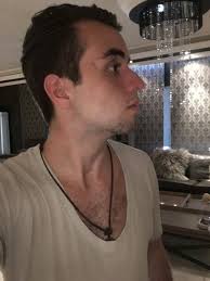 Craniofacial Changes In Children-Birth To Late Adolescence | Arc Journal Of  Forensic Science