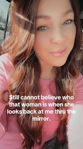 I was currently diagnosed with alopecia (mild as of now) having the gastric  sleeve