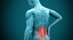 If your pain is still relatively intense, try placing a pillow under your knees and low back for added comfort. Suffering From A Herniated Disc Huffman Spine Clinic Lumbar Disc Herniation