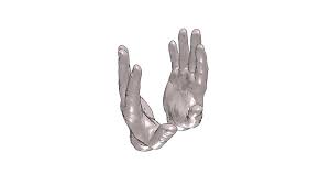 (die hand kann bei einigen patienten normal ausgebildet sein). Hand 3d Human