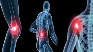 It's used to describe several conditions that cause inflammation in your joints. L Arthrose Une Fatalite Physio Multiservices