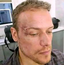 Sam heughan : I'm asking this for the last time' should I get a Tattoo