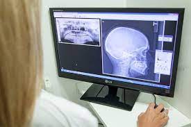 Cuando Recurrir A Un Especialista Ante Un Dolor De Mandibula La Tercera