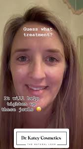 Can you guess what treatment I’m marking myself up for?, Comment below if  you know what it is. It’s my number 1 (or maybe it is tox) treatment I’m  going to get once I stop breastfeeding to help ...