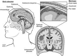 The cns is so named because the brain integrates the received information and coordinates and influences the activity of all parts of the bodies of bilaterally symmetric animals—i.e. Central Nervous System Infections As A Cause Of An Altered Mental Status What Is The Pathogen Growing In Your Central Nervous System Emergency Medicine Clinics