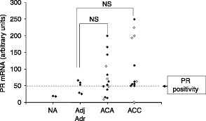 Ppnad is responsible for less than 2% of cases. Expression Of Progesterone And Estradiol Receptors In Normal Adrenal Cortex Adrenocortical Tumors And Primary Pigmented Nodular Adrenocortical Disease In Endocrine Related Cancer Volume 15 Issue 2 2008