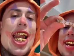 Conheça os famosos que aderiram ao 'grillz'
