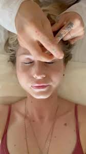 #acupuncture #chinesemedicine #health #tcm #wellness #massage  #acupunctureworks #acupuncturist #cupping #chiropractic #massagetherapy  #holistichealth #healing #traditionalchinesemedicine #acupuntura ...