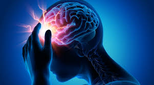 Concussion is among the most commonly occurring forms of traumatic brain injury and is sometimes referred to as mild traumatic brain injury. Concussion Baseline Testing What Is It And How Is It Used Elite Learning