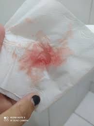 Grávida com pílula do dia seguinte | BabyCenter