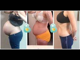 First Time Mom With Diastasis Recti Recovers With Bellefit Corset Youtube