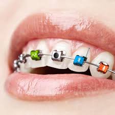 Kinder lieben es, ihren eltern einen kleinen streich spielen zu können. Aprilscherze Digitale Zahnspangen Und Verstopfte Dsl Leitungen Der Spiegel