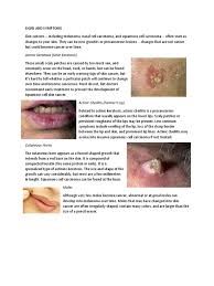 Abcde the mnemonic abcde should be kept in mind for any type of skin lesion. Skin Cancer Signs And Treatment Skin Cancer Cancer