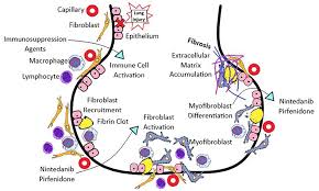 Frontiers Systemic Sclerosis Associated Interstitial Lung Disease New Directions In Disease Management Medicine
