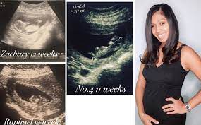 Gambar scan jantina bayi lelaki gambar scan jantina bayi lelaki. Nourul Depp Kongsi Scan Hangpa Teringin Baby Girl Ka Gempak